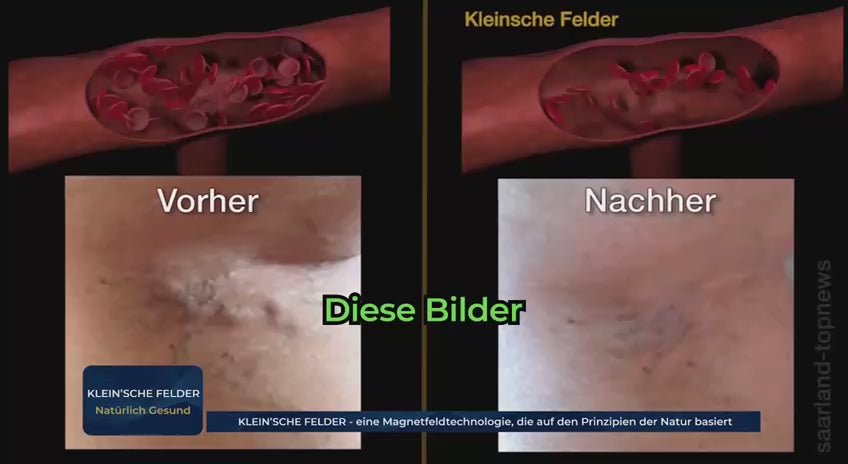 Load video: BIORELAX® Klein'sche Felder – Unterstützung von Durchblutung und Mikrozirkulation